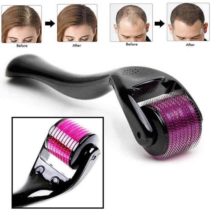 Derma Roller System for Hair And Skin 0.5 Mm Hair & Skin Care Derma Roller
