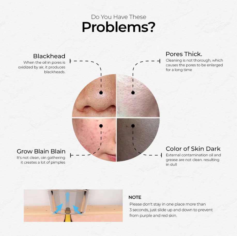 Vacuum Pore Cleaner – 6-in-1 Blackhead Remover